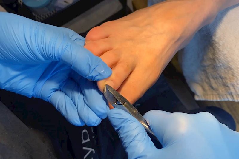 Pedikérka stříhá nehty nohou klientky pomocí nůžek